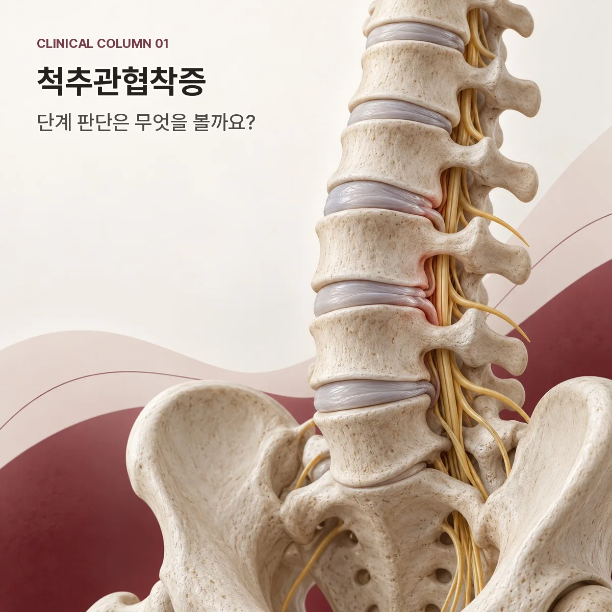 척추관협착증 평가 항목과 단계 판단 – 의정부365경희한의원