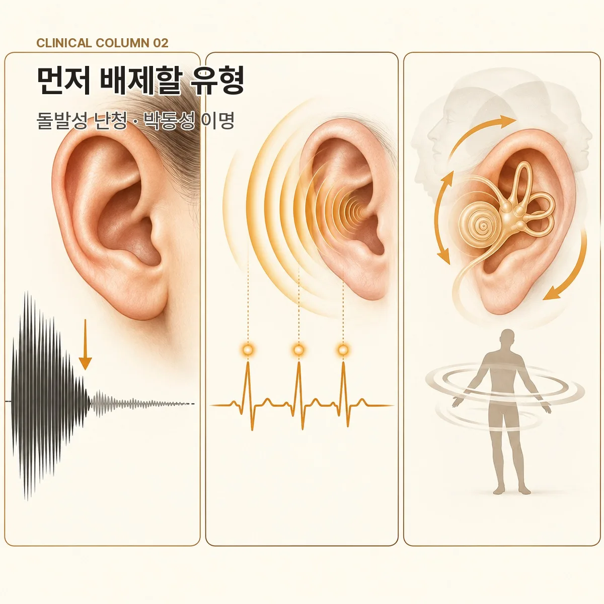 돌발성 난청과 박동성 이명의 배제 확인